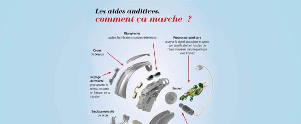 audioprothèse