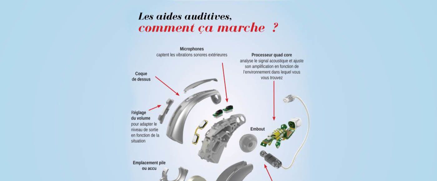 audioprothèse